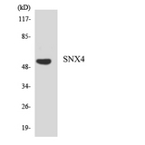 SNX4 Antibody - Western blot analysis of the lysates from HeLa cells using SNX4 antibody.