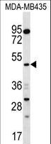 SNX4 Antibody - SNX4 Antibody western blot of MDA-MB435 cell line lysates (35 ug/lane). The SNX4 antibody detected the SNX4 protein (arrow).