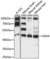 SNX4 Antibody - Western blot analysis of extracts of various cell lines, using SNX4 antibody at 1:1000 dilution. The secondary antibody used was an HRP Goat Anti-Rabbit IgG (H+L) at 1:10000 dilution. Lysates were loaded 25ug per lane and 3% nonfat dry milk in TBST was used for blocking. An ECL Kit was used for detection and the exposure time was 10s.
