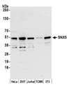 SNX5 Antibody - Detection of human and mouse SNX5 by western blot. Samples: Whole cell lysate (15 µg) from HeLa, HEK293T, Jurkat, mouse TCMK-1, and mouse NIH 3T3 cells prepared using NETN lysis buffer. Antibody: Affinity purified rabbit anti-SNX5 antibody used for WB at 0.1 µg/ml. Detection: Chemiluminescence with an exposure time of 30 seconds.