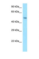 SNX5 Antibody - SNX5 antibody Western blot of Mouse Pancreas lysate. Antibody concentration 1 ug/ml.  This image was taken for the unconjugated form of this product. Other forms have not been tested.