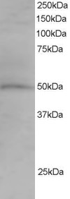 SNX5 Antibody - Antibody staining (1.5 ug/ml) of Jurkat lysate (RIPA buffer, 35 ug total protein per lane). Primary incubated for 1 hour. Detected by Western blot of chemiluminescence.