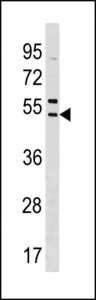 SNX5 Antibody - SNX5 Antibody western blot of HL-60 cell line lysates (35 ug/lane). The SNX5 antibody detected the SNX5 protein (arrow).