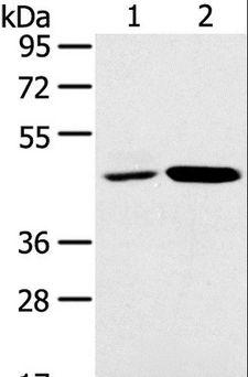 SNX5 Antibody - Western blot analysis of K562 and Jurkat cell, using SNX5 Polyclonal Antibody at dilution of 1:250.