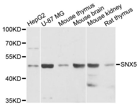 SNX5 Antibody - Western blot analysis of extracts of various cell lines, using SNX5 antibody at 1:3000 dilution. The secondary antibody used was an HRP Goat Anti-Rabbit IgG (H+L) at 1:10000 dilution. Lysates were loaded 25ug per lane and 3% nonfat dry milk in TBST was used for blocking. An ECL Kit was used for detection and the exposure time was 90s.