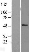 SNX5 Protein - Western validation with an anti-DDK antibody * L: Control HEK293 lysate R: Over-expression lysate
