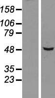 SNX5 Protein - Western validation with an anti-DDK antibody * L: Control HEK293 lysate R: Over-expression lysate