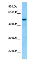 SNX6 Antibody - SNX6 antibody Western Blot of Human Placenta.  This image was taken for the unconjugated form of this product. Other forms have not been tested.