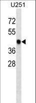 SNX6 Antibody - SNX6 Antibody western blot of U251 cell line lysates (35 ug/lane). The SNX6 antibody detected the SNX6 protein (arrow).