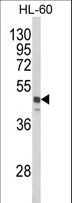 SNX6 Antibody - Western blot of SNX6 Antibody in HL-60 cell line lysates (35 ug/lane). SNX6 (arrow) was detected using the purified antibody.