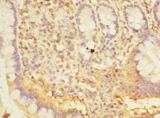 SNX6 Antibody - Immunohistochemistry of paraffin-embedded human small intestine tissue using antibody at dilution of 1:100.