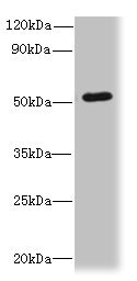 SNX6 Antibody - Western blot All lanes: SNX6 antibody at 4µg/ml + Hela whole cell lysate Secondary Goat polyclonal to rabbit IgG at 1/10000 dilution Predicted band size: 47, 34 kDa Observed band size: 47 kDa