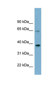 SNX7 Antibody - SNX7 antibody Western blot of Fetal Liver lysate. This image was taken for the unconjugated form of this product. Other forms have not been tested.