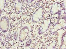 SNX7 Antibody - Immunohistochemistry of paraffin-embedded human small intestine tissue at dilution 1:100
