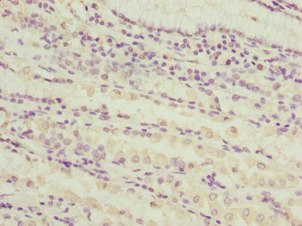 SNX7 Antibody - Immunohistochemistry of paraffin-embedded human stomach tissue at dilution 1:100