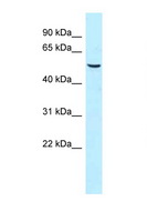 SNX8 Antibody - SNX8 antibody Western blot of Fetal Heart lysate. Antibody concentration 1 ug/ml.  This image was taken for the unconjugated form of this product. Other forms have not been tested.