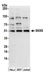 SNX8 Antibody - Detection of human SNX8 by western blot. Samples: Whole cell lysate (10 µg) from HeLa, HEK293T, and Jurkat cells prepared using NETN lysis buffer. Antibody: Affinity purified rabbit anti-SNX8 antibody used for WB at 0.1 µg/ml. Detection: Chemiluminescence with an exposure time of 3 minutes.