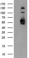 SNX8 Antibody - HEK293T cells were transfected with the pCMV6-ENTRY control (Left lane) or pCMV6-ENTRY SNX8 (Right lane) cDNA for 48 hrs and lysed. Equivalent amounts of cell lysates (5 ug per lane) were separated by SDS-PAGE and immunoblotted with anti-SNX8.