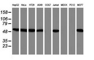 SNX8 Antibody - Western blot of extracts (35 ug) from 9 different cell lines by using anti-SNX8 monoclonal antibody.