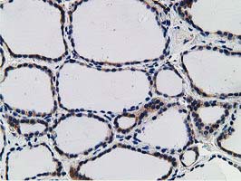 SNX8 Antibody - IHC of paraffin-embedded Human thyroid tissue using anti-SNX8 mouse monoclonal antibody.