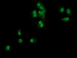 SNX8 Antibody - Anti-SNX8 mouse monoclonal antibody immunofluorescent staining of COS7 cells transiently transfected by pCMV6-ENTRY SNX8.