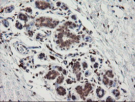 SNX8 Antibody - IHC of paraffin-embedded Human breast tissue using anti-SNX8 mouse monoclonal antibody.