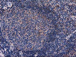 SNX8 Antibody - IHC of paraffin-embedded Human lymph node tissue using anti-SNX8 mouse monoclonal antibody.