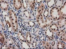 SNX8 Antibody - IHC of paraffin-embedded Human Kidney tissue using anti-SNX8 mouse monoclonal antibody. (Heat-induced epitope retrieval by 10mM citric buffer, pH6.0, 100C for 10min).