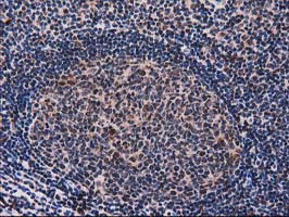 SNX8 Antibody - IHC of paraffin-embedded Human lymph node tissue using anti-SNX8 mouse monoclonal antibody. (Heat-induced epitope retrieval by 10mM citric buffer, pH6.0, 100C for 10min).