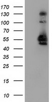 SNX8 Antibody - HEK293T cells were transfected with the pCMV6-ENTRY control (Left lane) or pCMV6-ENTRY SNX8 (Right lane) cDNA for 48 hrs and lysed. Equivalent amounts of cell lysates (5 ug per lane) were separated by SDS-PAGE and immunoblotted with anti-SNX8.