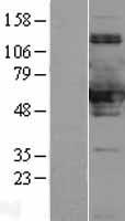 SNX8 Protein - Western validation with an anti-DDK antibody * L: Control HEK293 lysate R: Over-expression lysate