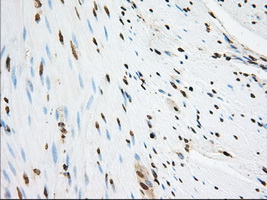 SNX9 / WISP Antibody - IHC of paraffin-embedded Human colon tissue using anti-SNX9 mouse monoclonal antibody. (Dilution 1:50).
