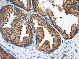 SNX9 / WISP Antibody - Immunohistochemical staining of paraffin-embedded Human prostate tissue using anti-SNX9 mouse monoclonal antibody. (Dilution 1:50).