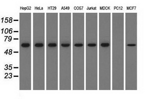 SNX9 / WISP Antibody - Western blot analysis of extracts (35ug) from 9 different cell lines by using anti-SNX9 monoclonal antibody.