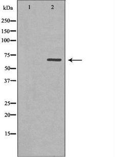 SNX9 / WISP Antibody - Western blot analysis of HeLa lysate using SNX9 antibody. The lane on the left is treated with the antigen-specific peptide.