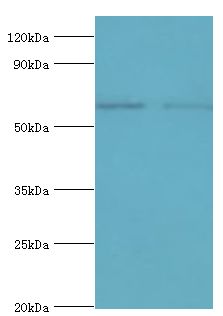 SOAT1 Antibody - Western blot. All lanes: Sterol O-acyltransferase 1 antibody at 2 ug/ml. Lane 1: 293T whole cell lysate. Lane 2: Jurkat whole cell lysate. Secondary antibody: Goat polyclonal to rabbit at 1:10000 dilution. Predicted band size: 65 kDa. Observed band size: 65 kDa Immunohistochemistry.