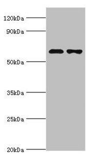 SOAT1 Antibody - Western blot All lanes: Sterol O-acyltransferase 1 antibody at 2µg/ml Lane 1: 293T whole cell lysate Lane 2: Jurkat whole cell lysate Secondary Goat polyclonal to rabbit IgG at 1/10000 dilution Predicted band size: 65, 59, 58 kDa Observed band size: 65 kDa