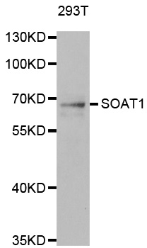 SOAT1 Antibody - Western blot analysis of extracts of 293T cells.