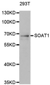 SOAT1 Antibody - Western blot analysis of extracts of 293T cells.