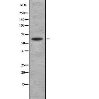 SOAT1 Antibody - Western blot analysis of SOAT1 using K562 whole lysates.