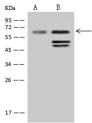SOAT1 Antibody - Anti-SOAT1 rabbit polyclonal antibody at 1:500 dilution. Lane A: HepG2 Whole Cell Lysate. Lane B: U-251 MG Whole Cell Lysate. Lysates/proteins at 30 ug per lane. Secondary: Goat Anti-Rabbit IgG (H+L)/HRP at 1/10000 dilution. Developed using the ECL technique. Performed under reducing conditions. Predicted band size: 65 kDa. Observed band size: 65 kDa. (We are unsure as to the identity of these extra bands.)