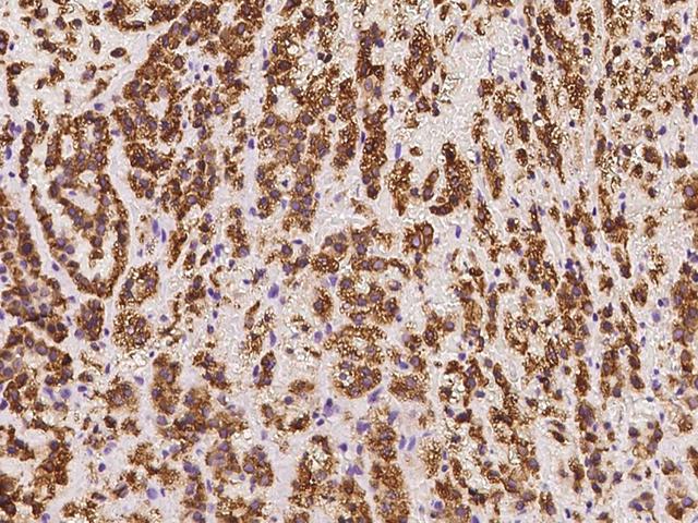 SOAT1 Antibody - Immunochemical staining of human SOAT1 in human adrenal gland with rabbit polyclonal antibody at 1:100 dilution, formalin-fixed paraffin embedded sections.