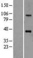 SOAT1 Protein - Western validation with an anti-DDK antibody * L: Control HEK293 lysate R: Over-expression lysate