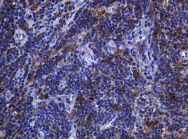 SOAT2 Antibody - IHC of paraffin-embedded Human lymph node tissue using anti-SOAT2 mouse monoclonal antibody.