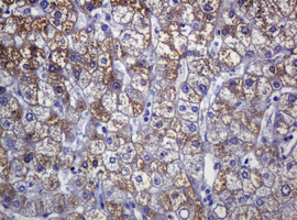 SOAT2 Antibody - IHC of paraffin-embedded Human liver tissue using anti-SOAT2 mouse monoclonal antibody.