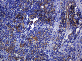 SOAT2 Antibody - IHC of paraffin-embedded Human tonsil using anti-SOAT2 mouse monoclonal antibody.