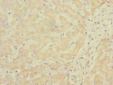 SOAT2 Antibody - Immunohistochemistry of paraffin-embedded human liver tissue at dilution 1:100