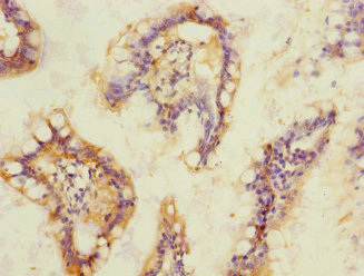 SOAT2 Antibody - Immunohistochemistry of paraffin-embedded human small intestine at dilution 1:100