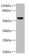SOAT2 Antibody - Western blot All Lanes: SOAT2 antibody IgG at 3.36ug/ml+ 293T whole cell lysate Secondary Goat polyclonal to rabbit IgG at 1/10000 dilution Predicted band size: 60,58,51,35 kDa Observed band size: 60 kDa