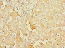 SOAT2 Antibody - Immunohistochemistry of paraffin-embedded human liver tissue at dilution 1:100